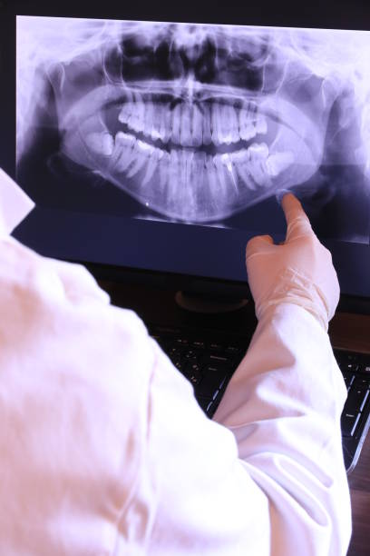 Best Emergency Root Canal Treatment in Dandridge, TN
