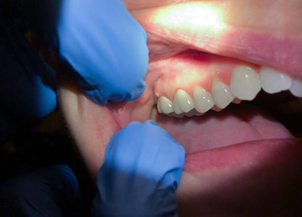 Best Same-Day Emergency Dentist in Dandridge, TN
